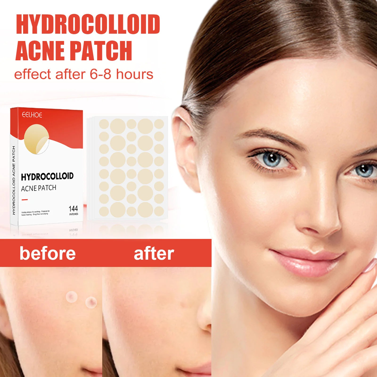 Invisible Hydrogel Acne Patch