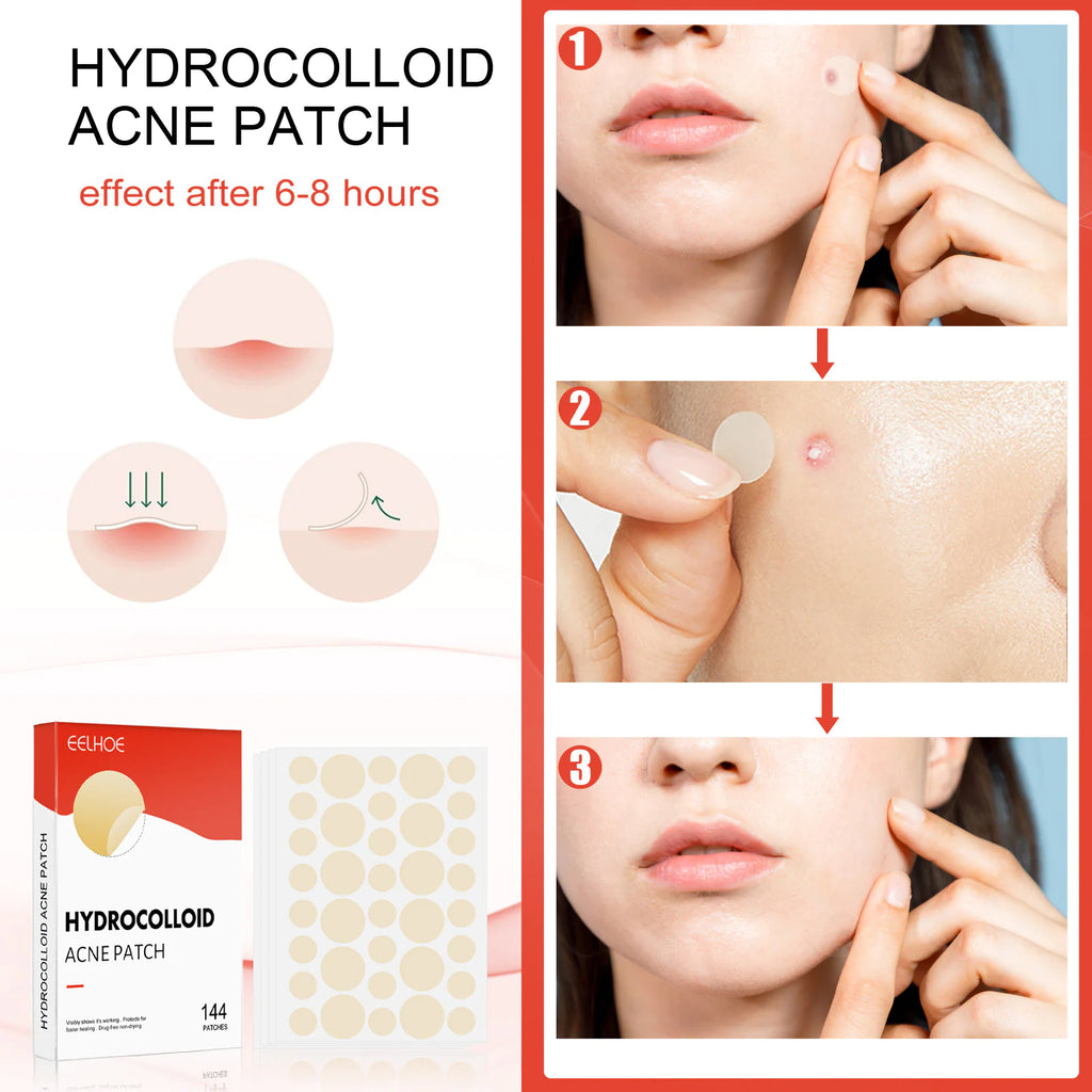 Invisible Hydrogel Acne Patch